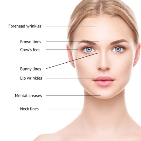 Vancouver botox and filler injections-initial virtual consult with Dr. Shiva Beiki